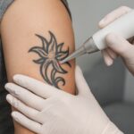 Fading Regrets: How Laser Tattoo Removal Gives You a Fresh Start